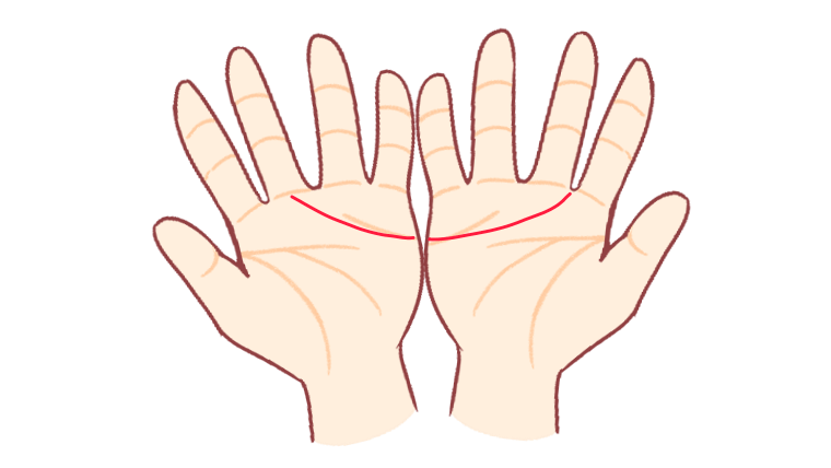 両手で感情線が繋がっていたら？